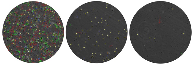 Normozoospermie                Astenozoospermie                Oligozoospermie